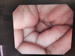 大腸ビデオスコープ｜CF-H260AL｜オリンパスメディカルシステムズ株式会社の写真12枚目