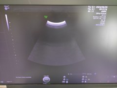 4D超音波診断装置（カラードプラ）｜Voluson E10｜GEヘルスケアの写真12枚目