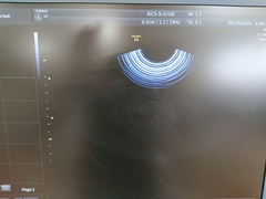 4D超音波診断装置（カラードプラ）｜Voluson E6｜GEヘルスケアの写真12枚目