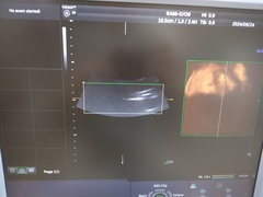 4D超音波診断装置（カラードプラ）｜Voluson E6｜GEヘルスケアの写真12枚目
