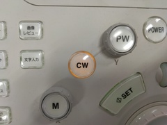 超音波診断装置（カラードプラ）｜Xario100 TUS-X100｜キヤノンメディカルシステムズの写真12枚目
