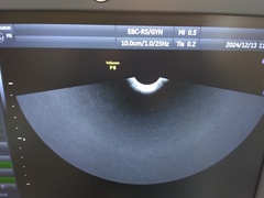 4D超音波診断装置（カラードプラ）｜Voluson P8｜GEヘルスケアの写真12枚目