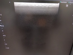 超音波診断装置（カラードプラ）｜Xario100 TUS-X100｜キヤノンメディカルシステムズの写真12枚目