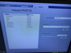 超音波診断装置｜Voluson P6｜GEヘルスケアの写真12枚目