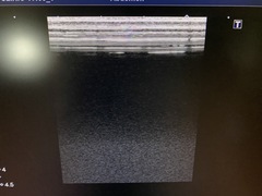 ｜Aplio 400 TUS-A400｜Canon Medical Systems photo12
