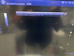 Ultrasound system(Color)｜LOGIQ S8 XDclear｜GE Healthcare photo12