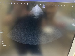 Ultrasound System(Color)｜Xario100 TUS-X100｜Canon Medical Systems photo12
