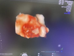 Ultrasound system(Color)｜Voluson E10｜GE Healthcare photo12