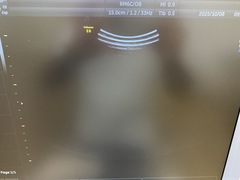 Ultrasound system(Color)｜Voluson E8 Expert｜GE Healthcare photo12