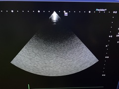 UltrasoundSystem｜Aplio a  Verifia/CUS-AA000｜Canon Medical Systems photo12