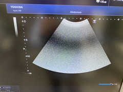 超音波診断装置｜Aplio 500 TUS-A500｜キヤノンメディカルシステムズの写真12枚目