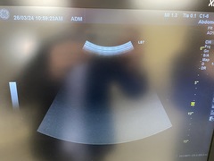 超音波診断装置｜LOGIQ S7 Expert｜GEヘルスケアの写真12枚目