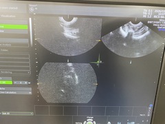 Ultrasound system(Color)｜Voluson P8｜GE Healthcare photo12