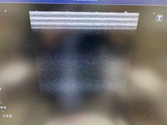 Ultrasound System(Color)｜XARIO 200 TUS‐X200S｜Canon Medical Systems photo12