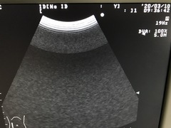 Ultrasound system｜Prosound 6｜Hitachi photo10