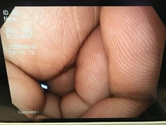 Video Gastroscope｜GIF-V70｜Olympus Medical Systems photo13