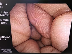 Video Colonoscope｜CF-Q260AI｜Olympus Medical Systems photo11