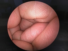 Video Transnasal Gastroscope｜EG-530N｜Fujifilm Medical photo9