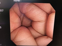 Video Colonoscope｜PCF-P240AI｜Olympus Medical Systems photo6