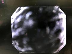 Video Colonoscope｜PCF-H290I｜Olympus Medical Systems photo6