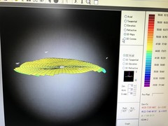 Corneal Topographer｜CT-1000｜Rexxam Co.,Ltd photo10
