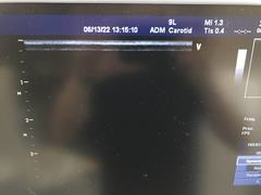 超音波診断装置（カラードプラ）｜Vivid 7 Dimension｜GEヘルスケアの写真13枚目