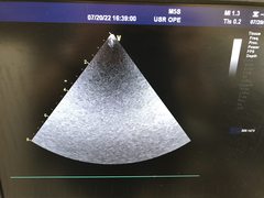 超音波診断装置(カラードプラ)ＬＣＤ｜Vivid E9｜GEヘルスケアの写真13枚目