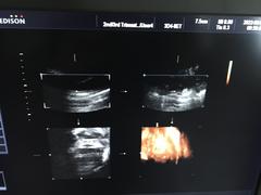 Ultrasound system｜SONOACE R7｜Samsung Medison photo13