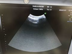 Ultrasound system(Color)｜Voluson e｜GE Healthcare photo13
