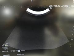 超音波診断装置（カラードプラ）｜ARIETTA 70｜日立製作所の写真13枚目