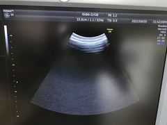 Ultrasound system(Color)｜Voluson E6｜GE Healthcare photo13