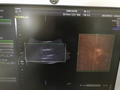 Ultrasound system(Color)｜Voluson S6｜GE Healthcare photo13