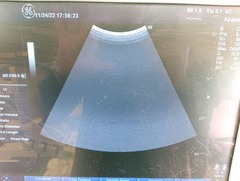 超音波診断装置（カラードプラ）｜LOGIQ P5｜GEヘルスケアの写真13枚目