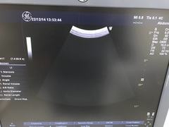 Ultrasound system(Color)｜LOGIQ P6｜GE Healthcare photo13