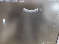 Ultrasound system(Color)｜LOGIQ S8｜GE Healthcare photo13
