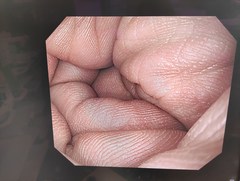 上部消化管汎用ビデオスコープ｜GIF-H290｜オリンパスメディカルシステムズ株式会社の写真13枚目