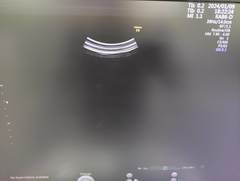 4D超音波診断装置（カラードプラ）｜Voluson E8｜GEヘルスケアの写真13枚目