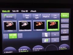 4D超音波診断装置（カラードプラ）｜Voluson E10｜GEヘルスケアの写真13枚目