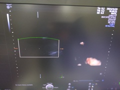 4D超音波診断装置（カラードプラ）｜Voluson E10｜GEヘルスケアの写真13枚目