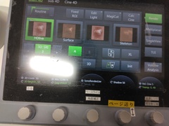 超音波診断装置｜Voluson S10｜GEヘルスケアの写真13枚目