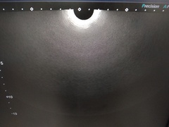 超音波診断装置（カラードプラ）｜Xario100 TUS-X100｜キヤノンメディカルシステムズの写真13枚目