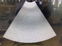 超音波診断装置(カラードプラ)ＬＣＤ｜Aplio 400 TUS-A400｜キヤノンメディカルシステムズの写真13枚目