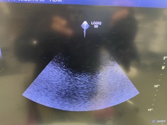 Ultrasound system(Color)｜LOGIQ S8 XDclear｜GE Healthcare photo13