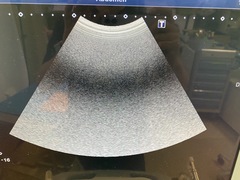 超音波診断装置(カラードプラ)ＬＣＤ｜Aplio 400 TUS-A400｜キヤノンメディカルシステムズの写真11枚目