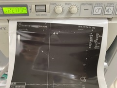 超音波診断装置（カラードプラ）｜LOGIQ P6｜GEヘルスケアの写真13枚目
