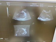 Ultrasound system(Color)｜Voluson E8 Expert｜GE Healthcare photo13