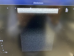 超音波診断装置｜Aplio 500 TUS-A500｜キヤノンメディカルシステムズの写真13枚目