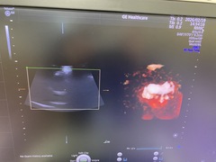 Ultrasound system(Color)｜Voluson E10｜GE Healthcare photo13