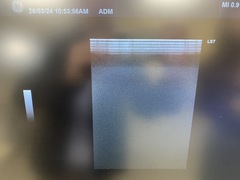 超音波診断装置｜LOGIQ S7 Expert｜GEヘルスケアの写真13枚目