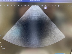 Ultrasound System(Color)｜XARIO 200 TUS‐X200S｜Canon Medical Systems photo13